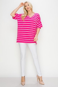 Women’s Striped Oversized Short Sleeve Top style 4